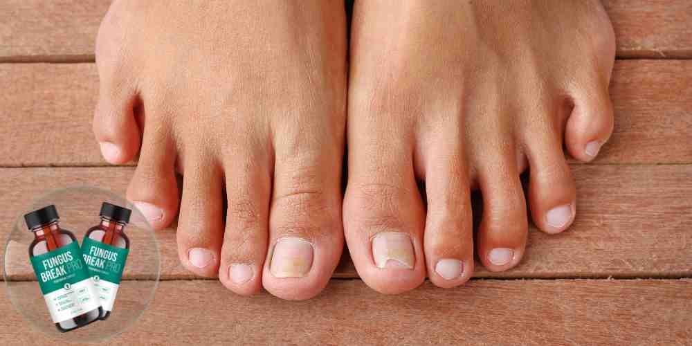 Toenail Fungus Vanished